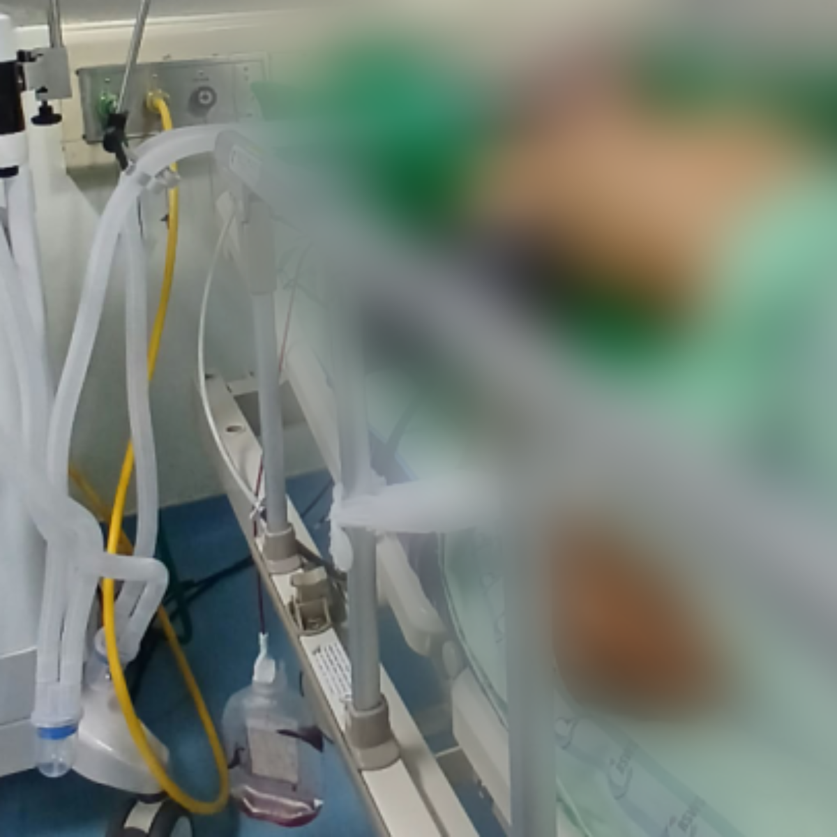 Korban Tabrak Lari di Gowa Dirawat di Makassar, Pelaku Belum Diketahui